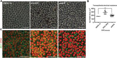 Transcriptional comparison of adult human primary Retinal Pigment Epithelium, human pluripotent stem cell-derived Retinal Pigment Epithelium, and ARPE19 cells